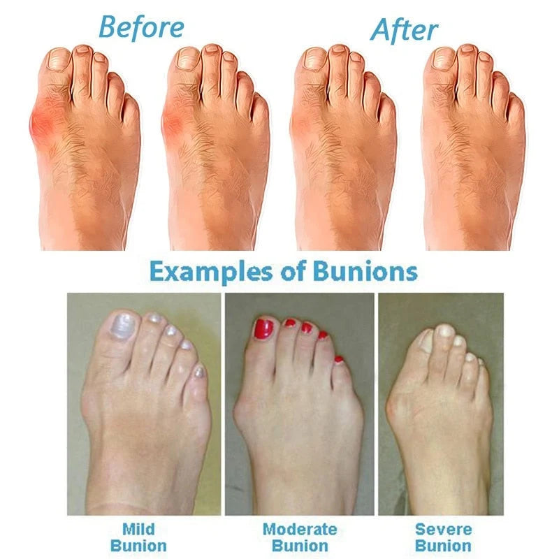 Women's Orthopedic Arch Support Sandals for Bunion Relief and Foot Pain Correction 7